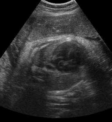 case0074-3