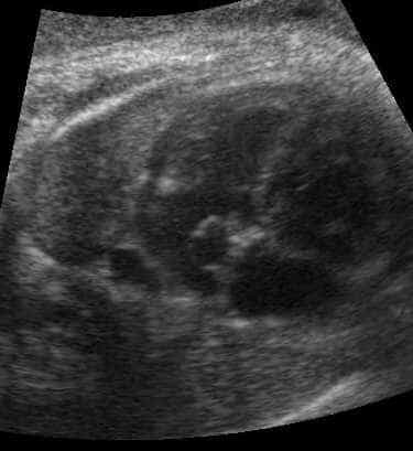 case0074-4