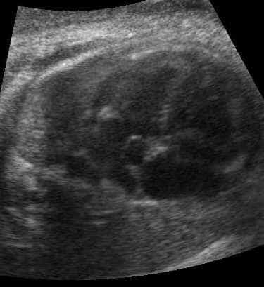 case0074-5