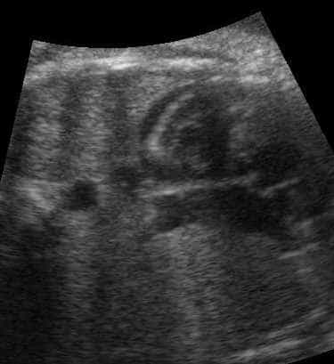 case0074-7