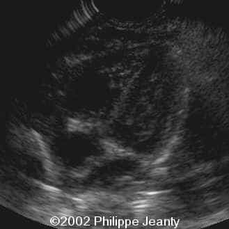 case0074-8