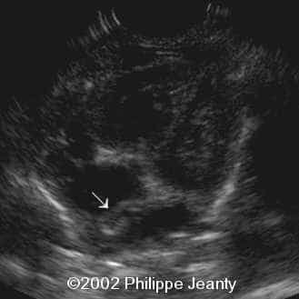 case0074-9