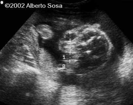 case0075-1