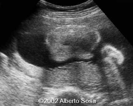 case0075-10