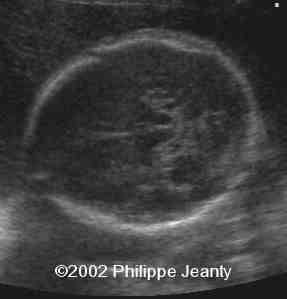 case0076-1