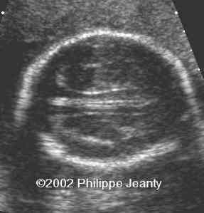 case0076-11