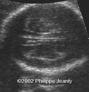 case0076-12