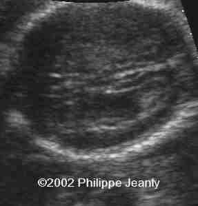 case0076-13