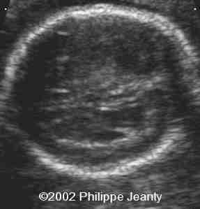 case0076-14