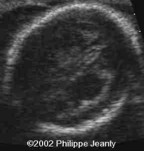 case0076-15