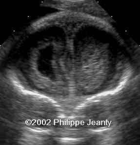 case0076-2