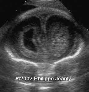 case0076-3