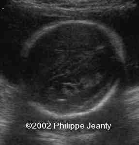 case0076-6