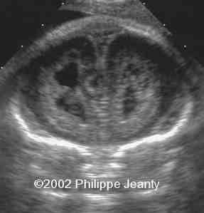 case0076-7
