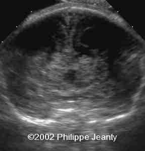 case0076-8