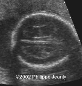 case0076-9