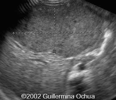 case0078_12