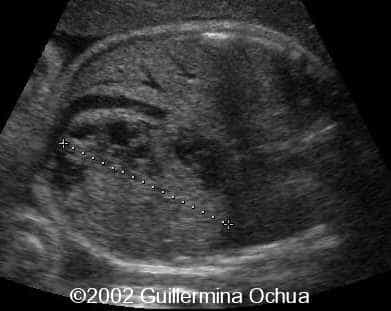 case0078_28