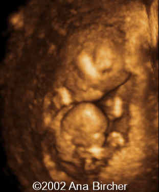 case0079_14