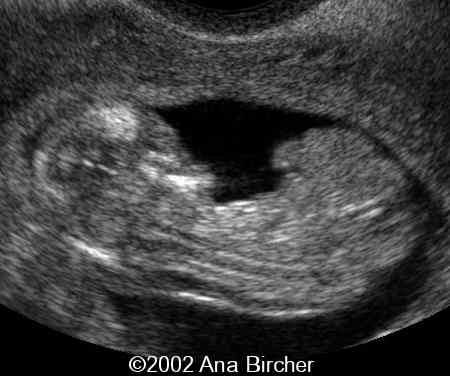 case0079_2