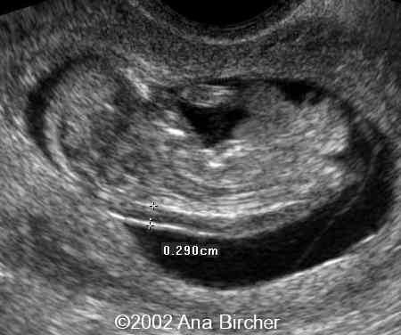 case0079_3