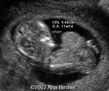 case0079_4