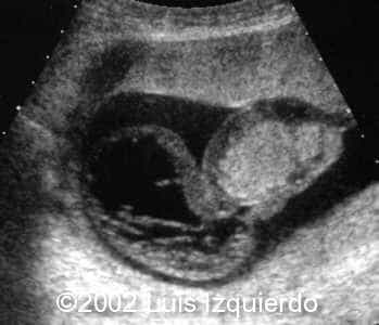 case0092-1