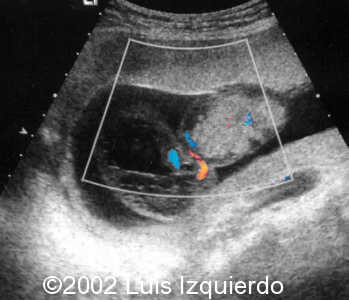 case0092-3