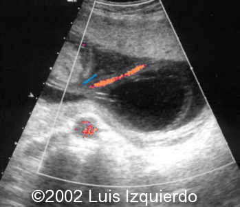 case0092-5