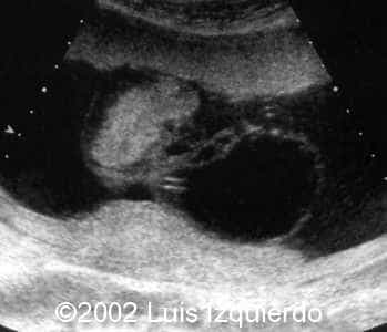case0092-6