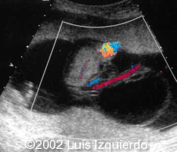 case0092-7