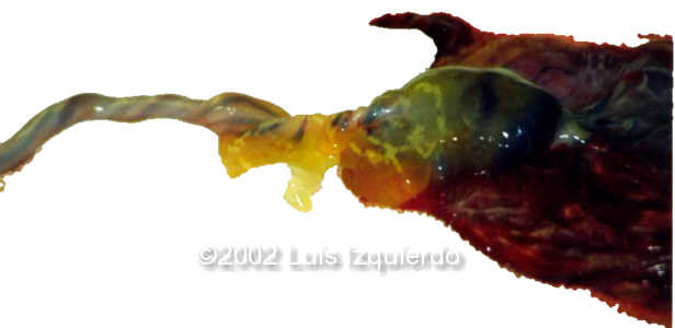 case0092-8