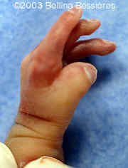 case0093-01