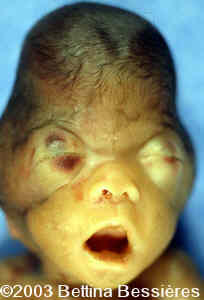 case0093-02
