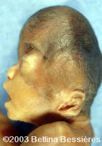 case0093-03