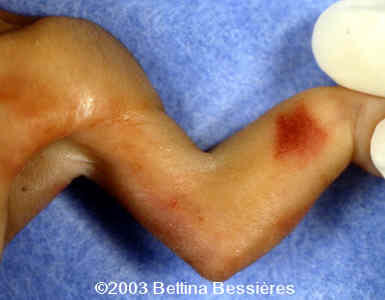 case0093-04