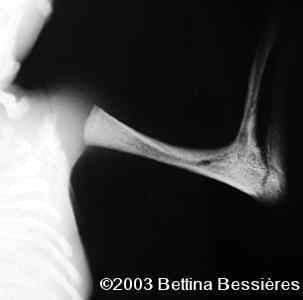case0093-05
