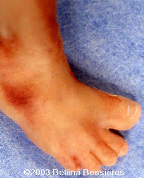 case0093-06