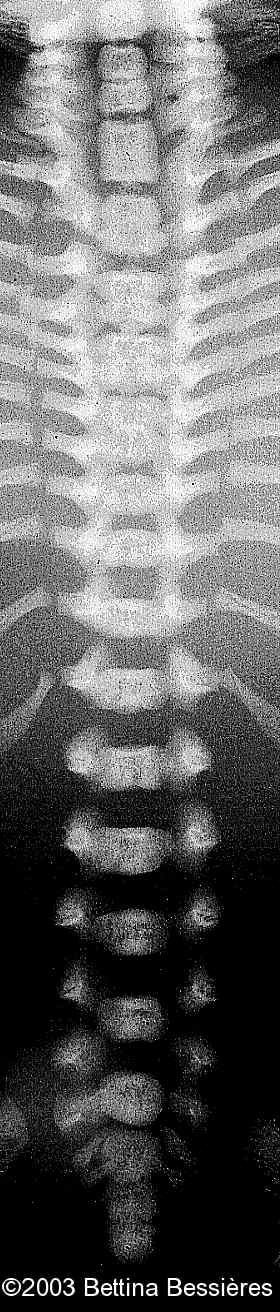 case0093-07