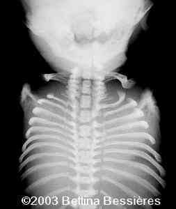 case0093-08