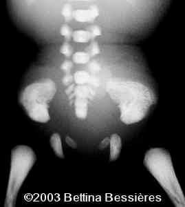 case0093-09