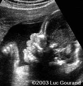 case0093-13