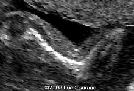 case0093-14