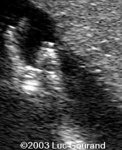 case0093-15