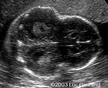 case0093-16