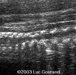 case0093-17
