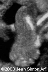 case0093-19