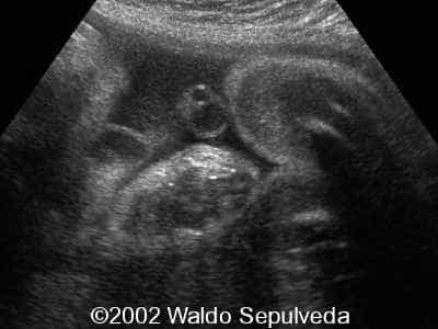 case0094-10