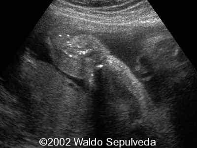 case0094-12