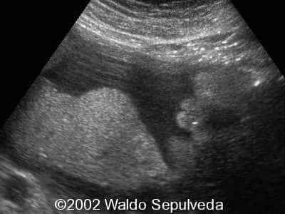 case0094-13